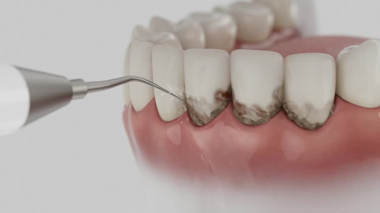 Trusted Root Canal Treatment service in Walhalla, SC - Dentist Open Now